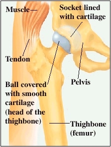 understanding hip replacement healthy