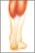 what is tendonitis of the foot back