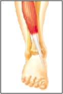 what is tendonitis of the foot front