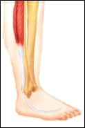 what is tendonitis of the foot right