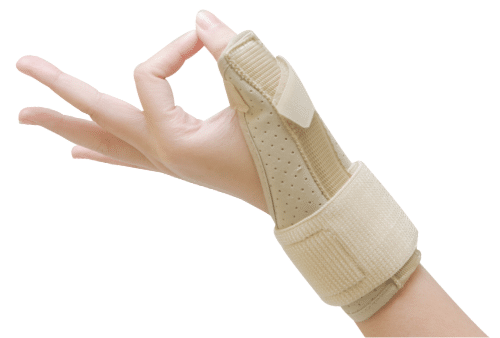 Thumb Restriction Splint Example
