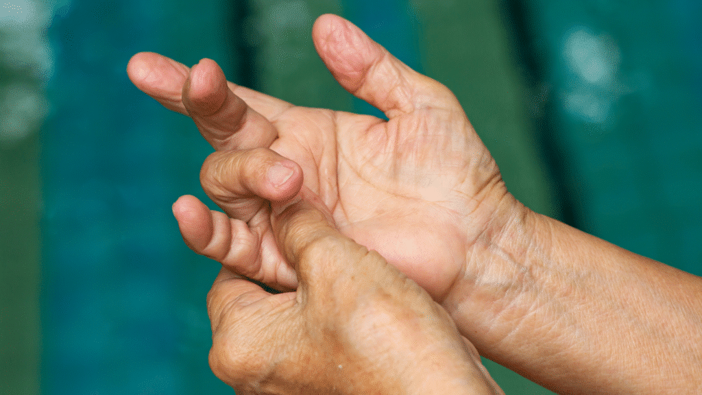 focus on hand with crooked bent fingers emphasizing on loss of function and pain